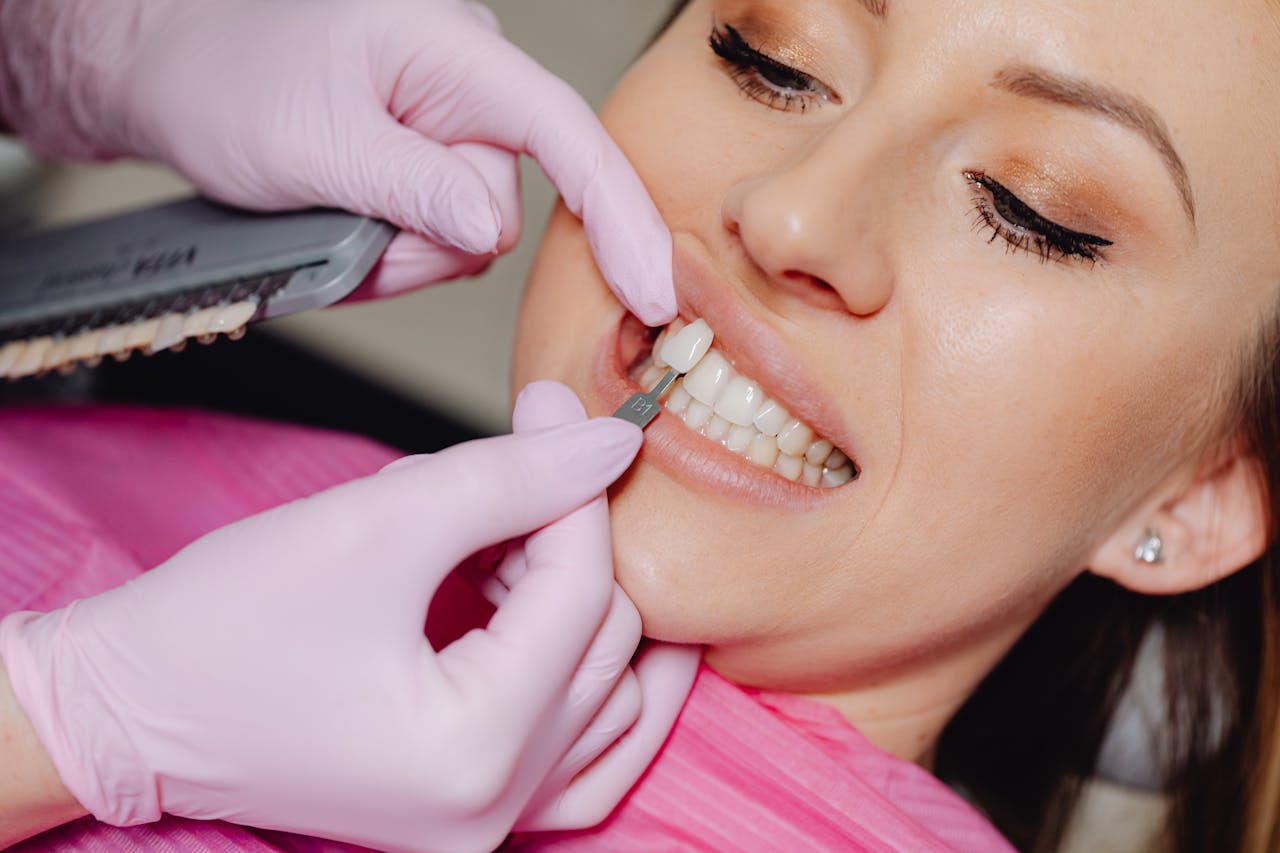 Close-up of a dental veneer being applied to a womans teeth at a clinic.